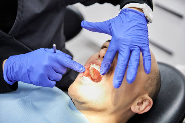Best Broken or Chipped Tooth Repair in Gnadenhutten, OH